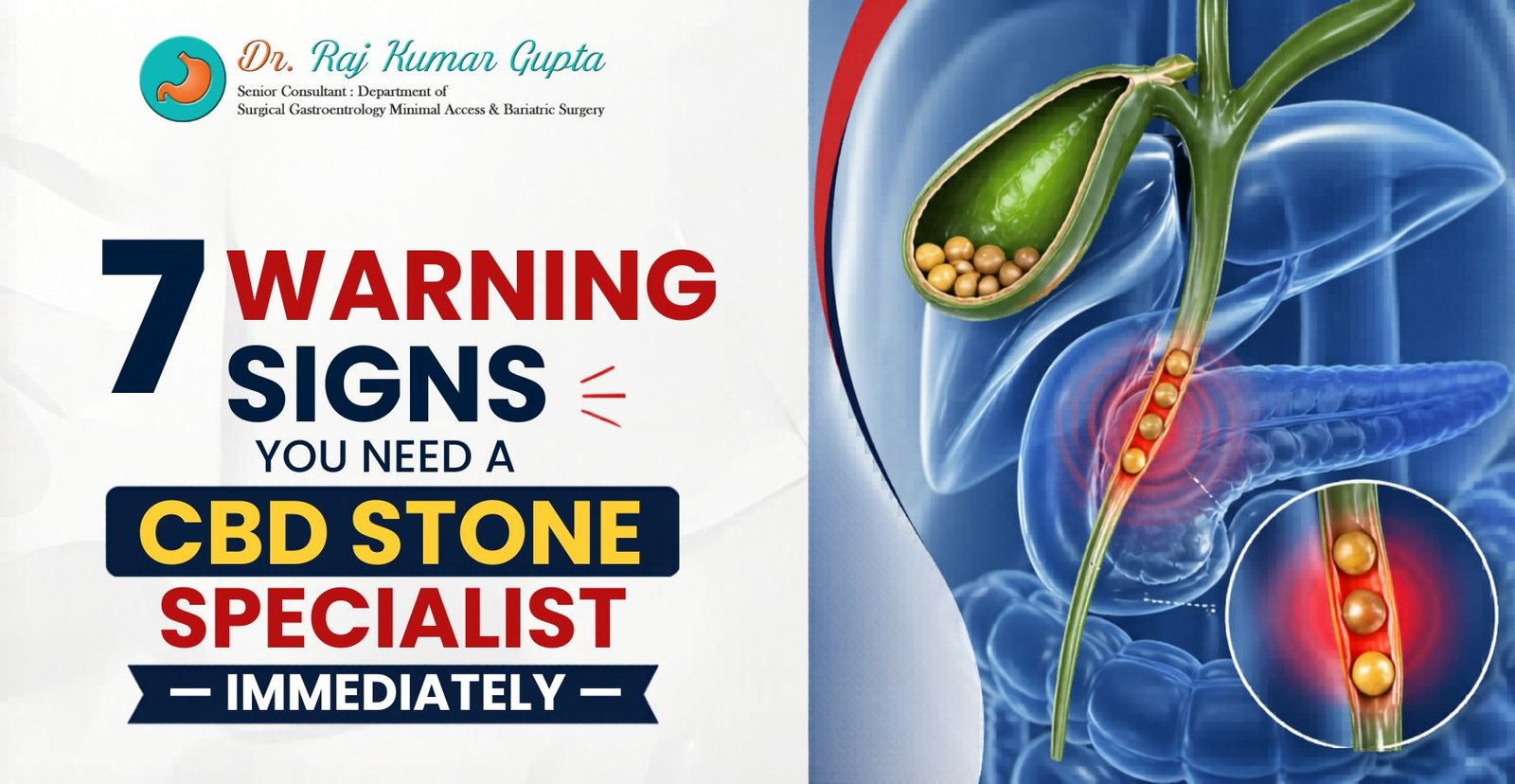 CBD Stone Specialist Surgeon
